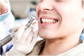 Teeth Polishing in Mallepally